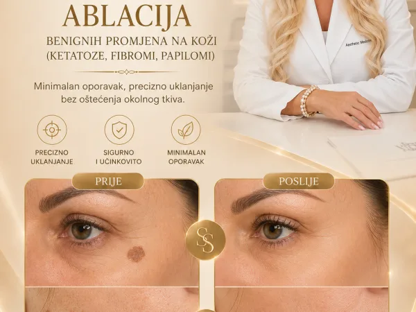 Radiotalasna ablacija
