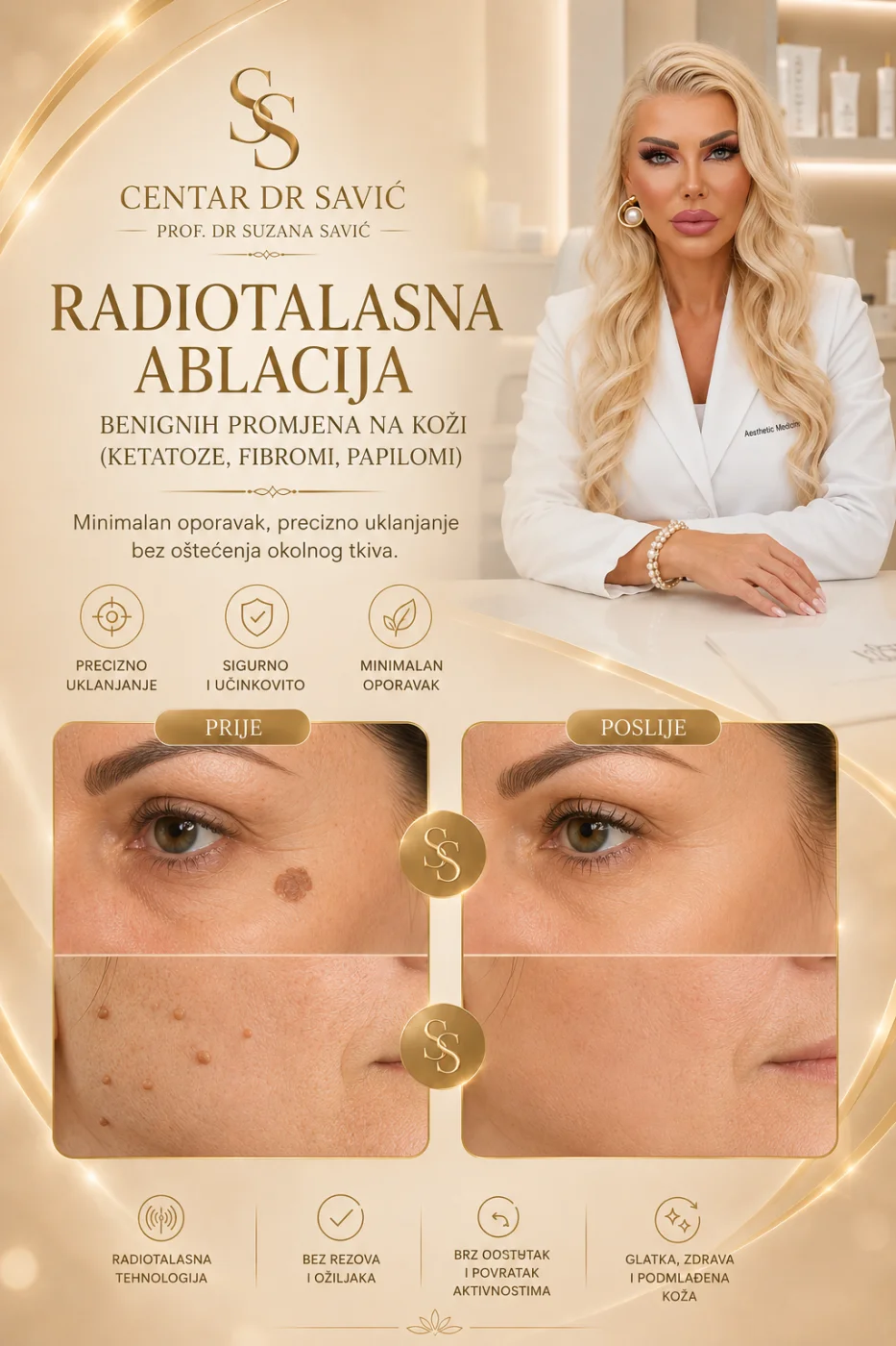 Radiotalasna ablacija