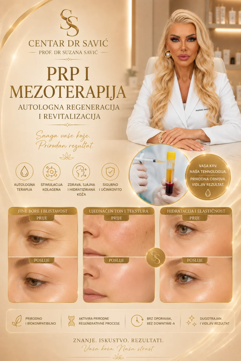 PRP i mezoterapija