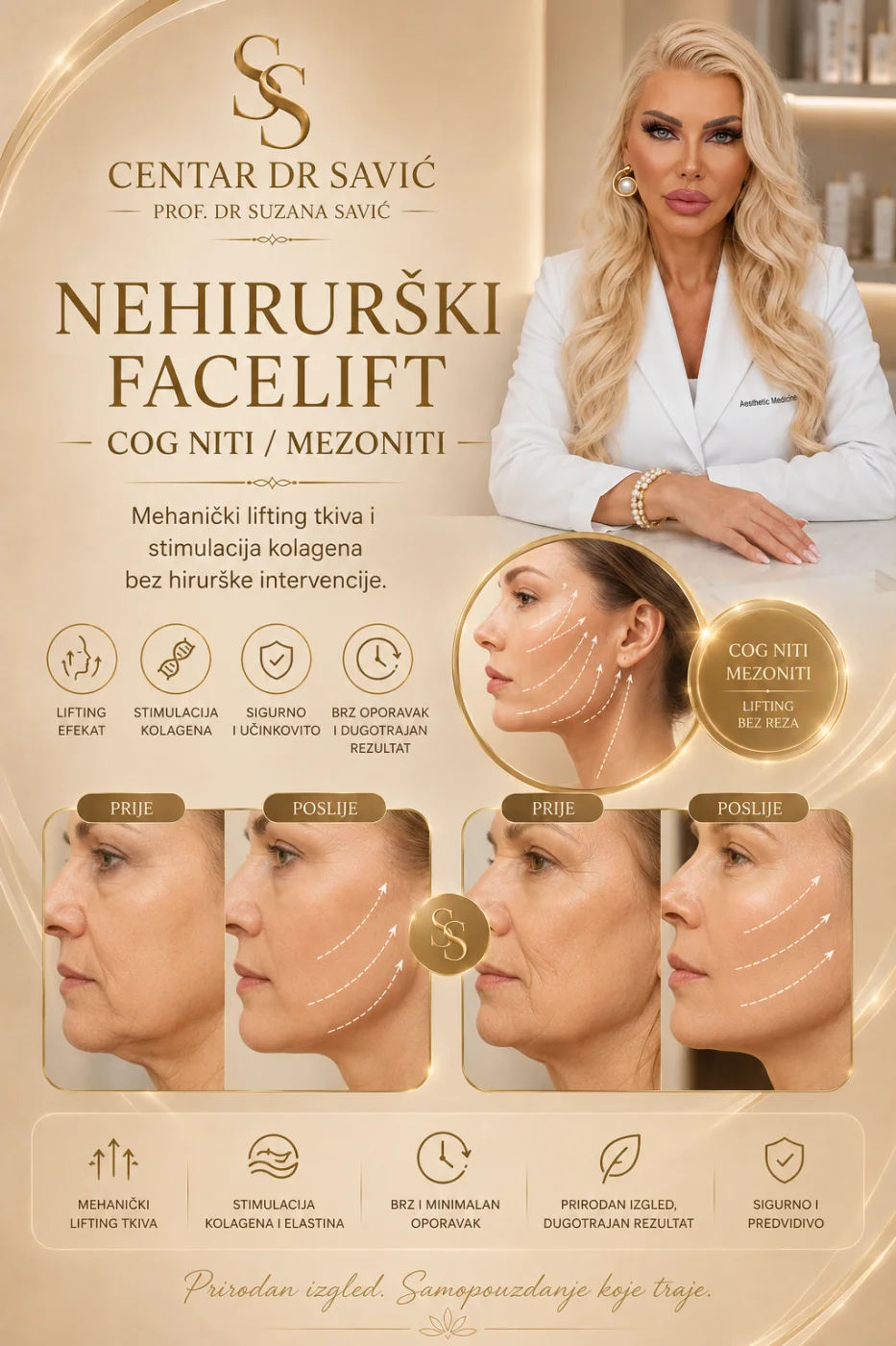 Nehirurški facelift – niti