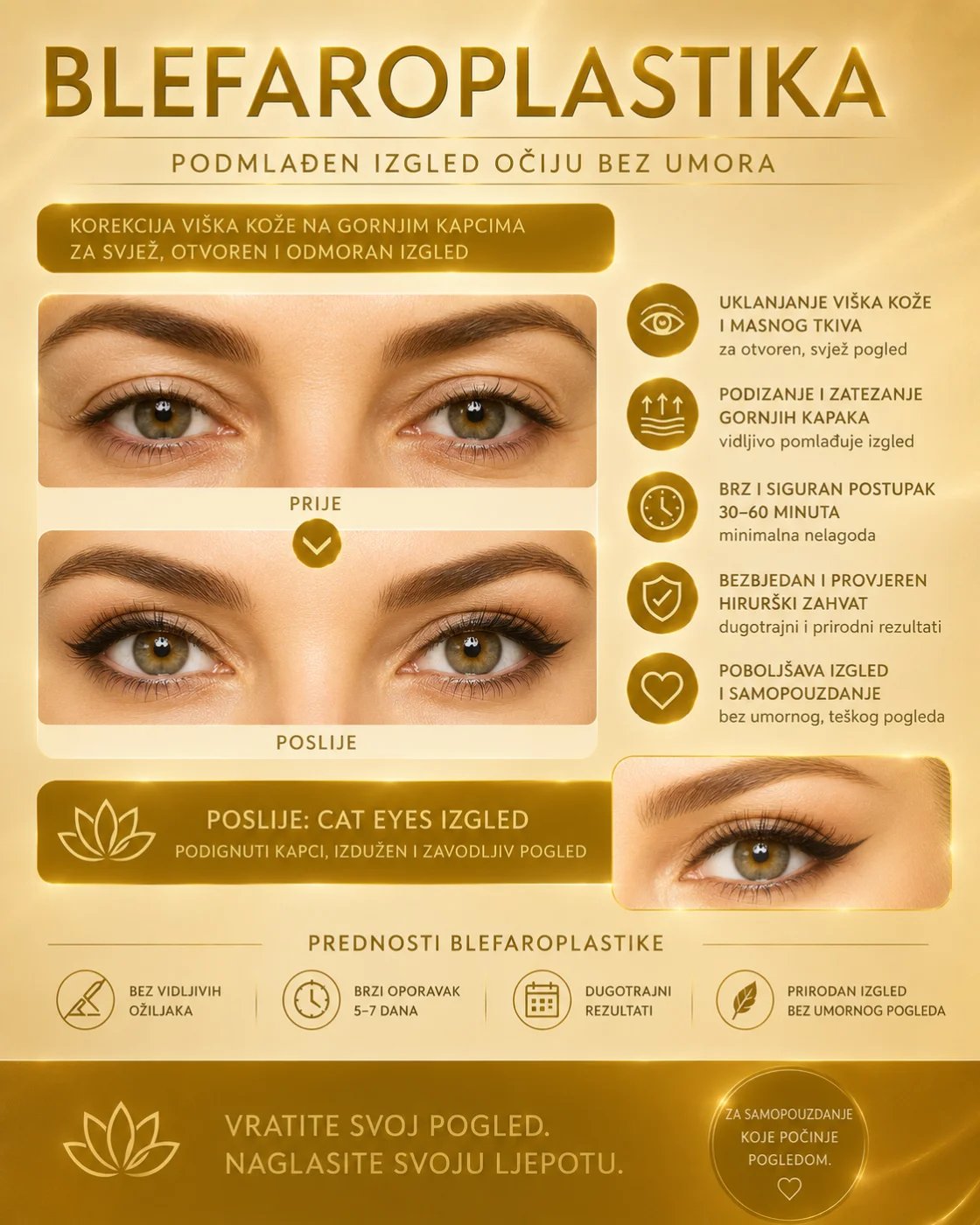 Blefaroplastika
