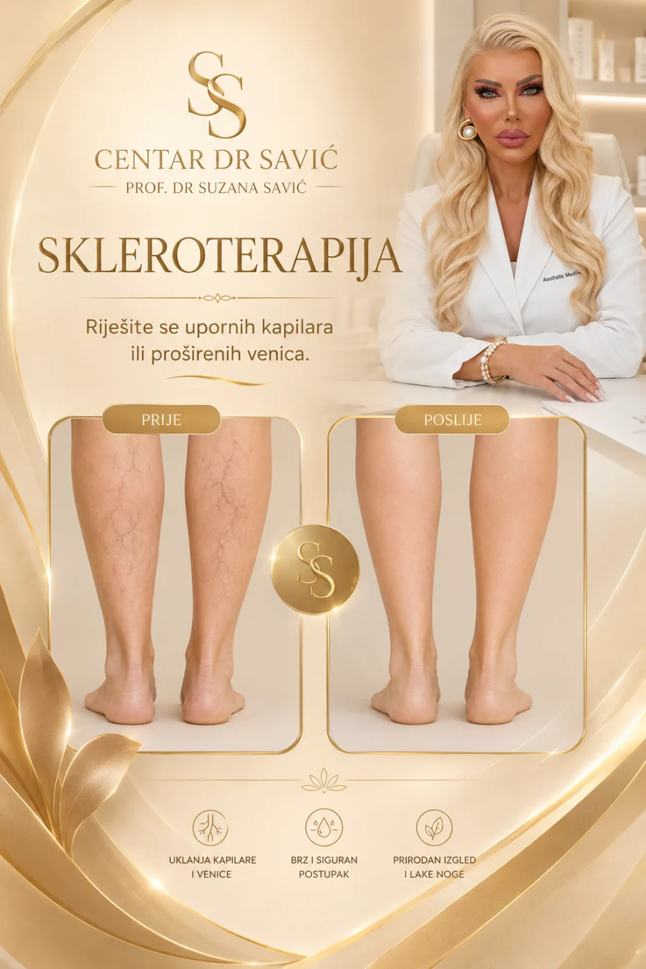 Skleroterapija