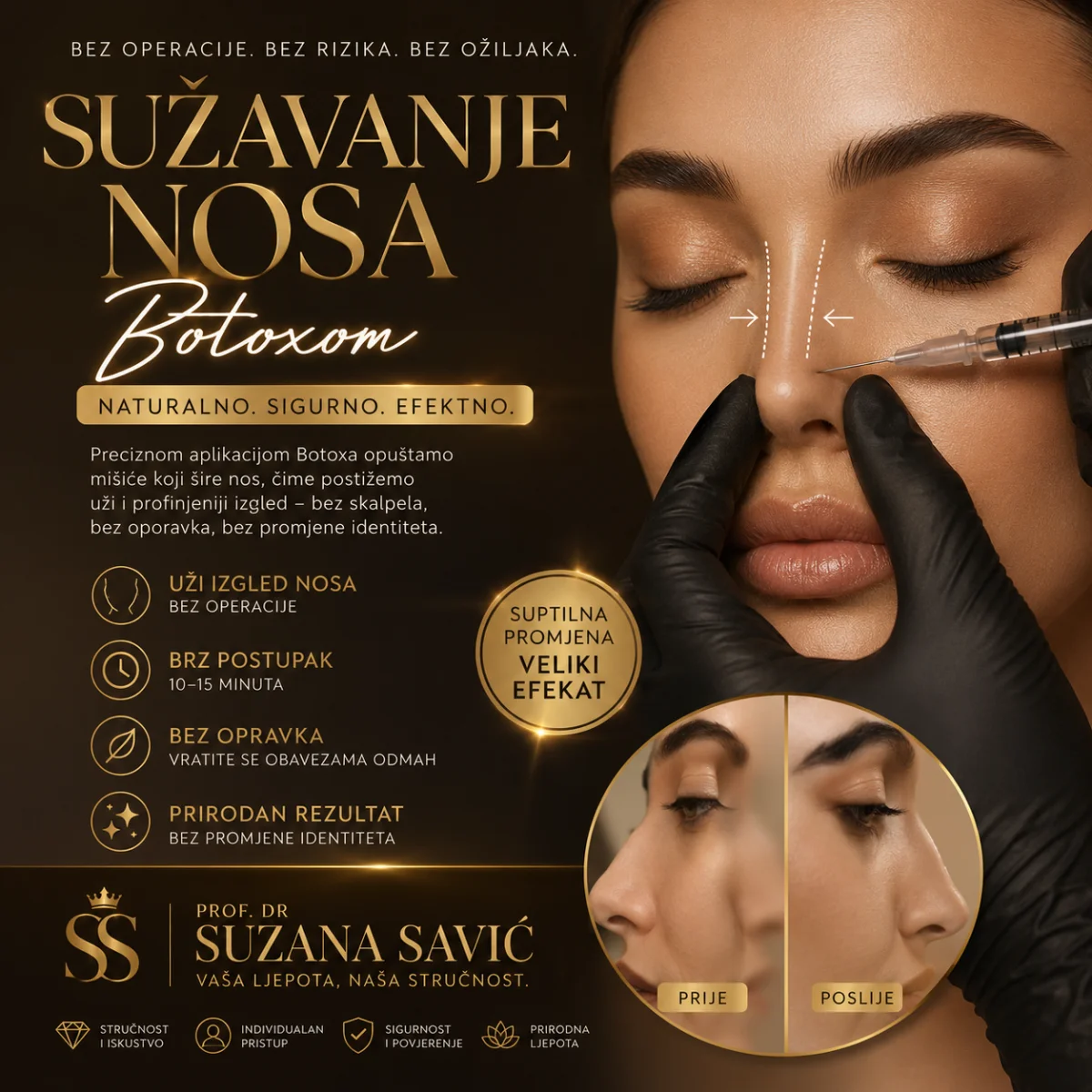 Sužavanje nosa botoksom